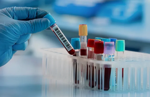 Hematology