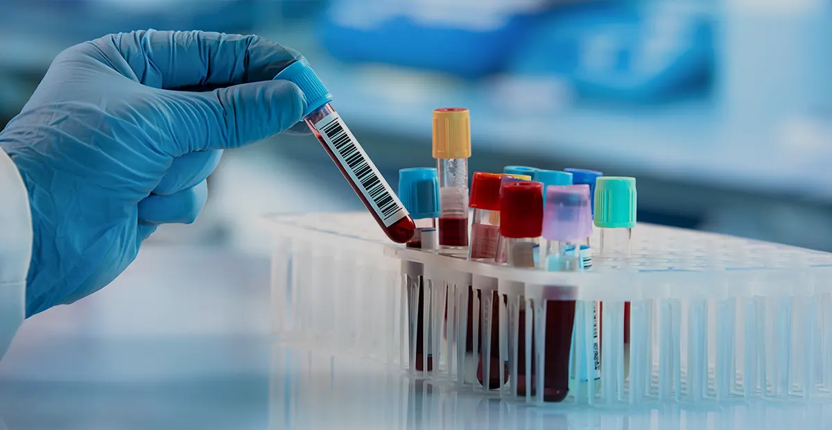 Hematology