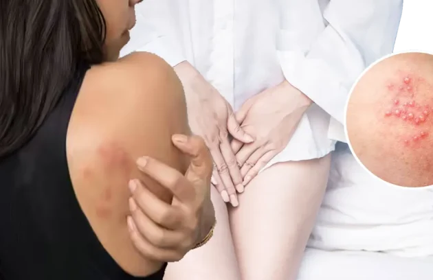 Skin and sexually transmitted diseases